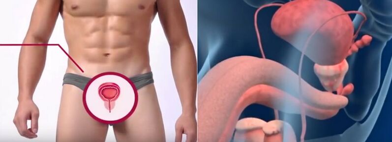 Prostatitis in men, known by certain signs